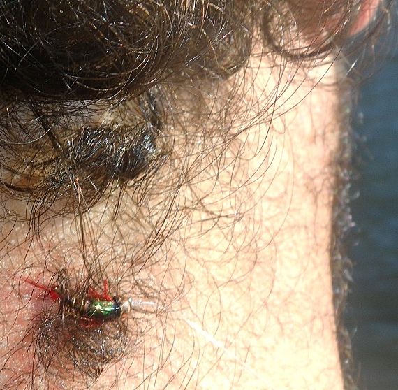 Ouch!